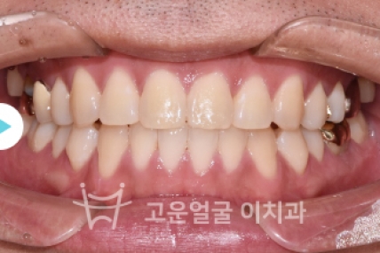 치료후기 이미지
